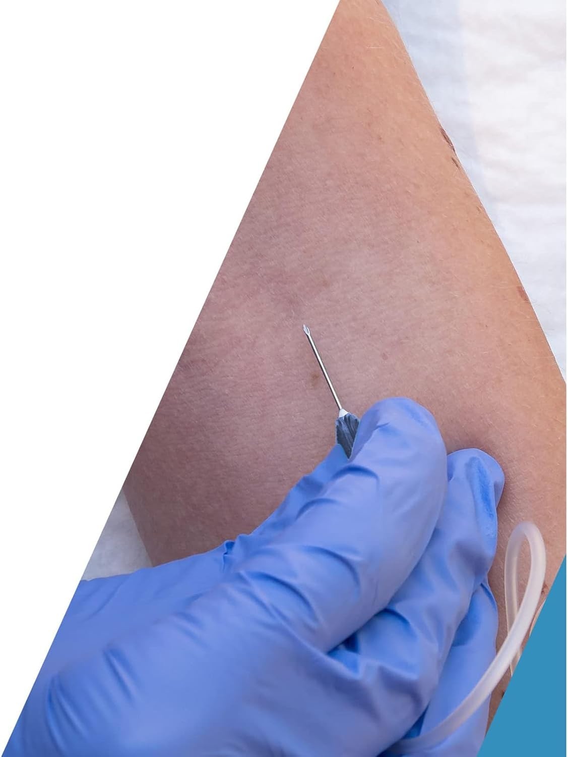 25G Safety Butterfly with Pre-Attached Holder New Sealed - Imagen 6