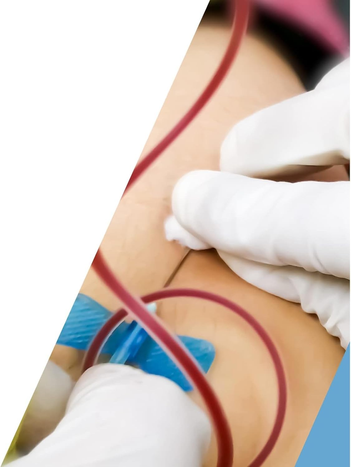 25G Safety Butterfly with Pre-Attached Holder New Sealed - Imagen 7